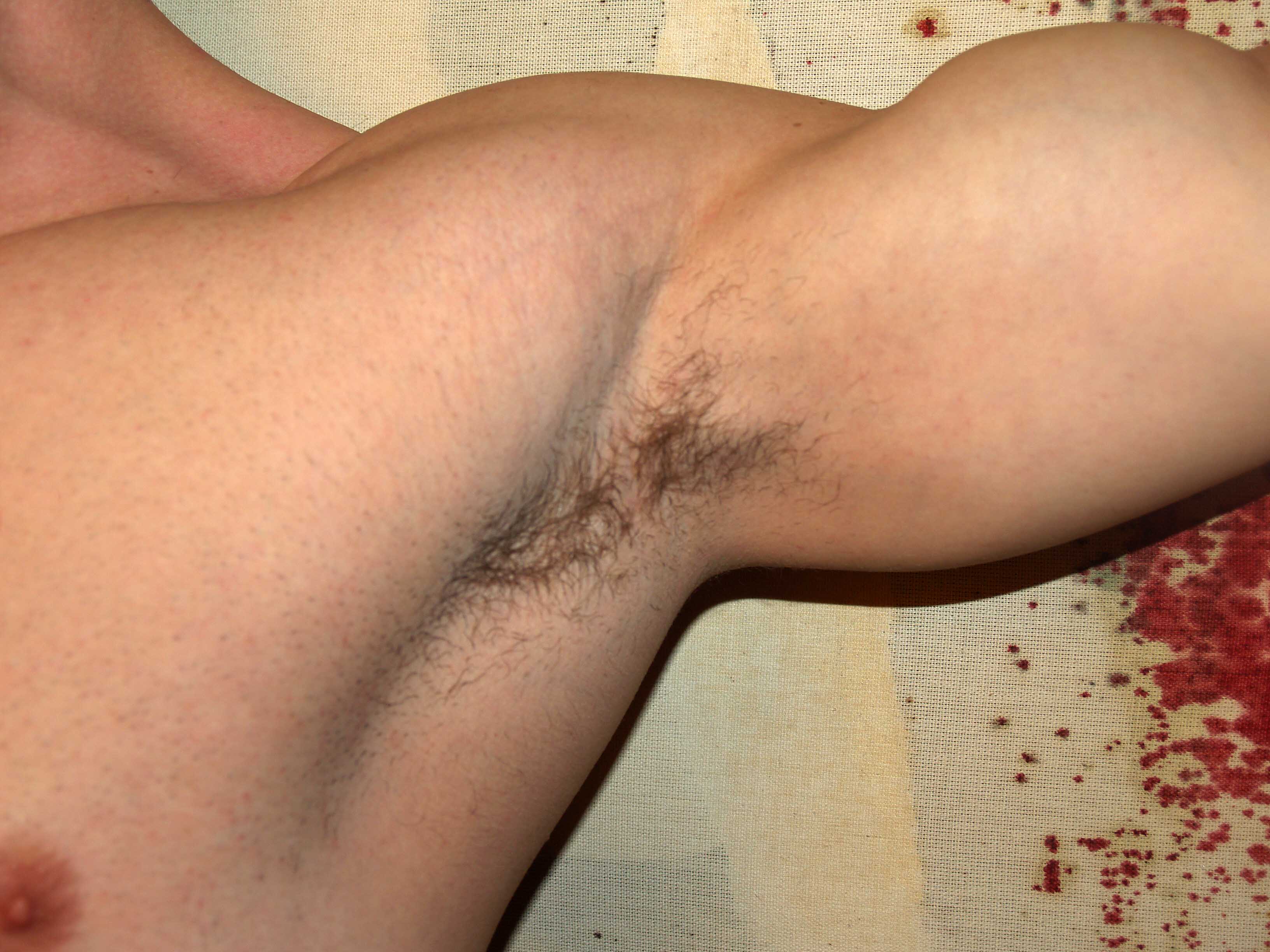 Armhule